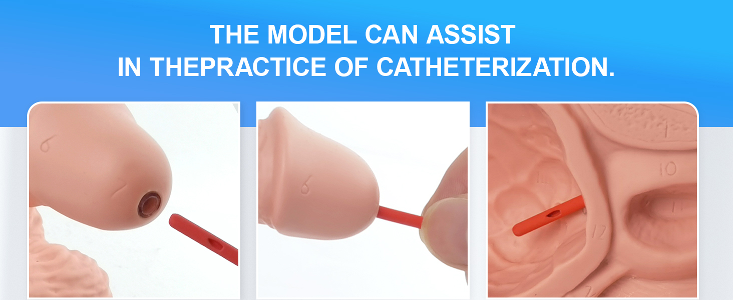 Catheterization Model