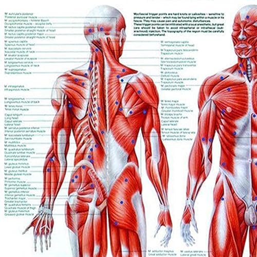 Trigger Points Laminated Chart - Poueer