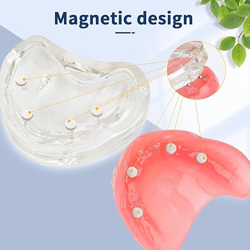 Upper Overdenture Model - Dental Implant Overdenture Model,Denture Model with Implants for Teaching and Studying - Poueer