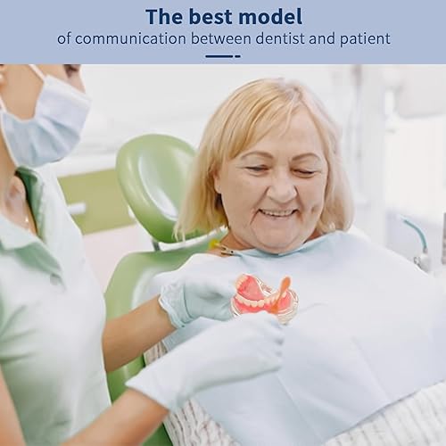 Upper Overdenture Model - Dental Implant Overdenture Model,Denture Model with Implants for Teaching and Studying - Poueer