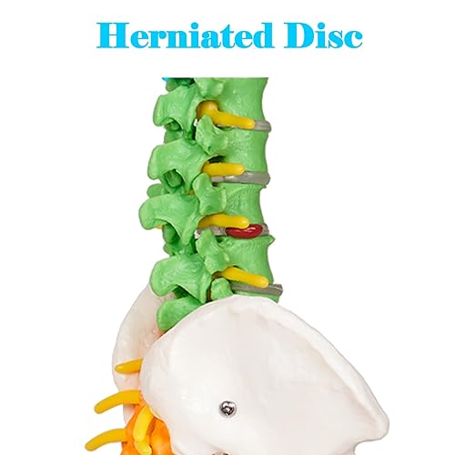 breesky Scientific Mini Spine Model, 15.5’’ Anatomical Spine Model with All Nerves, Human Anatomy Model with Stand for Instruction, Study and Display - Poueer