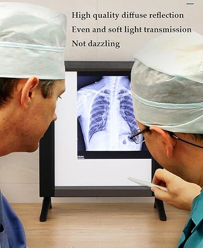 X-Ray LED Viewbox, Slide Viewer Illuminator Light Box X-Ray Viewer Light Panel for Hospital X-Film or CT-Film Lab Equipment - Poueer