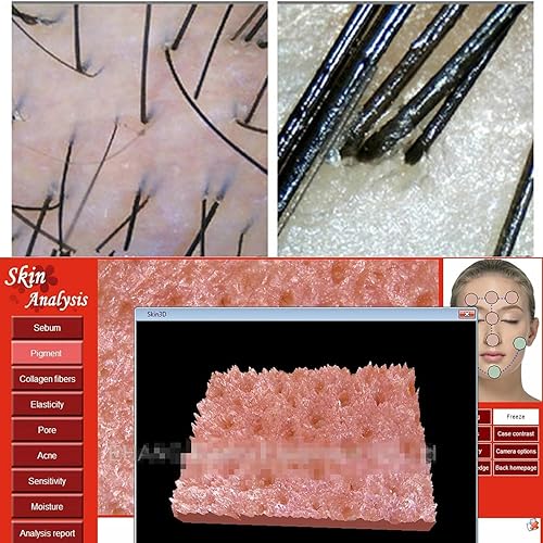 Iriscope Iridology Camera, 5.0 Mp USB Iris Analyzer Iridology Camera, 5.0m Pixels USB Left/Right Lamp Analyzer/Analysis Iridology Camera with Pro Iris Software - Poueer