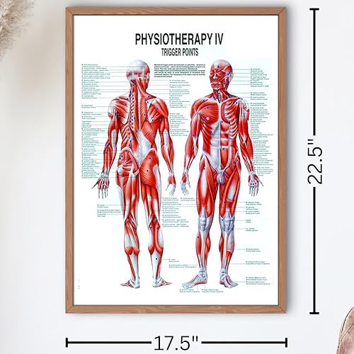 Trigger Points Laminated Chart - Poueer