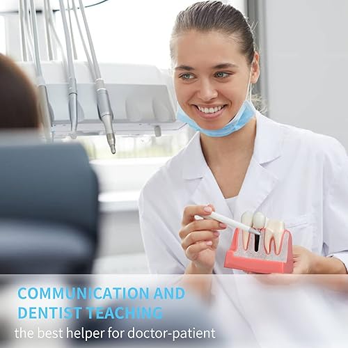 ANNWAN Dental Implant Model 4 Times Removable Analysis Crown Bridge Demonstration Teeth Model for Class Education and Studying Teeth Model - Poueer
