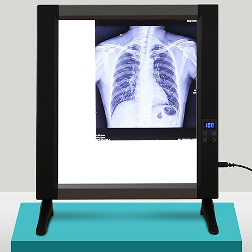 X-Ray LED Viewbox, Slide Viewer Illuminator Light Box X-Ray Viewer Light Panel for Hospital X-Film or CT-Film Lab Equipment - Poueer