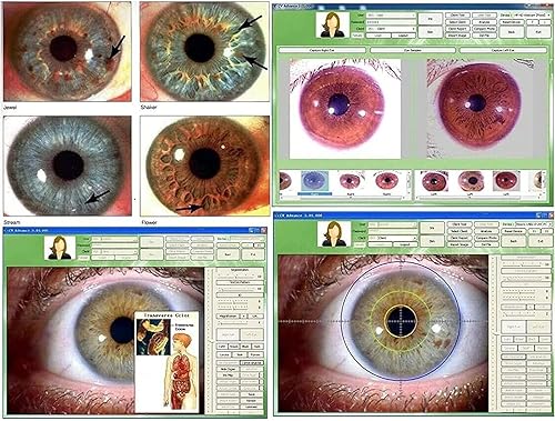 Iriscope Iridology Camera, 5.0 Mp USB Iris Analyzer Iridology Camera, 5.0m Pixels USB Left/Right Lamp Analyzer/Analysis Iridology Camera with Pro Iris Software - Poueer