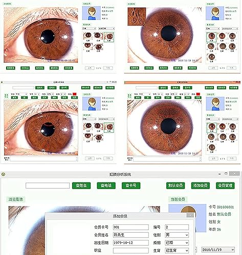 Iriscope Iridology Camera, 5.0 Mp USB Iris Analyzer Iridology Camera, 5.0m Pixels USB Left/Right Lamp Analyzer/Analysis Iridology Camera with Pro Iris Software - Poueer