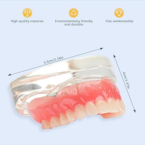 Upper Overdenture Model - Dental Implant Overdenture Model,Denture Model with Implants for Teaching and Studying - Poueer