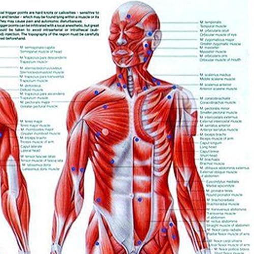 Trigger Points Laminated Chart - Poueer
